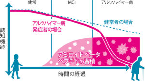 軽度認知症（MCI）スクリーニング検査 | 脳神経外科 やまうちクリニック