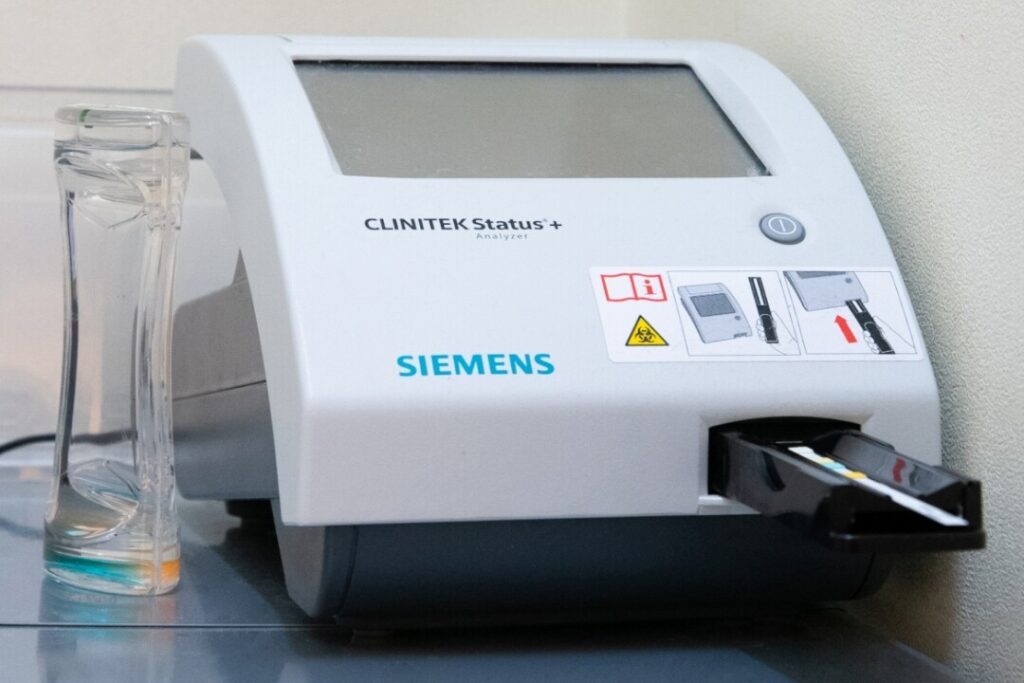 小型尿分析装置
クリニテックステータスプラス